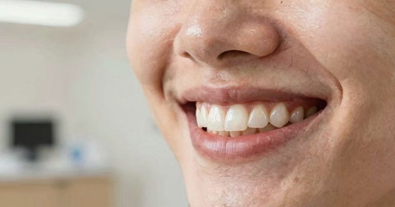 céramique dentaire capdentaire: sourire naturel durable